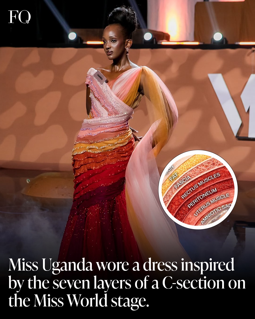 First slide of a carousel by @femalequotient: Miss Uganda wore a dress inspired by the seven layers of a C-section on the Miss World stage.